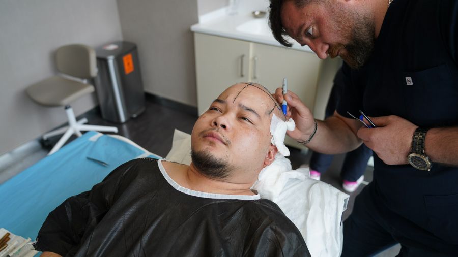 Bank of Hair - Haartransplantation Türkei