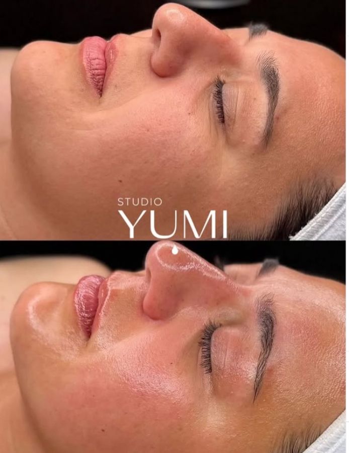 Yumi Beauty Güzellik Merkezi